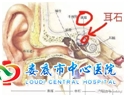 耳石症的健康知识