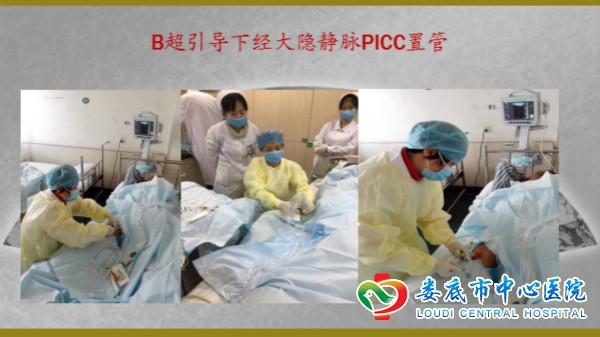 我科PICC置管“成长记”